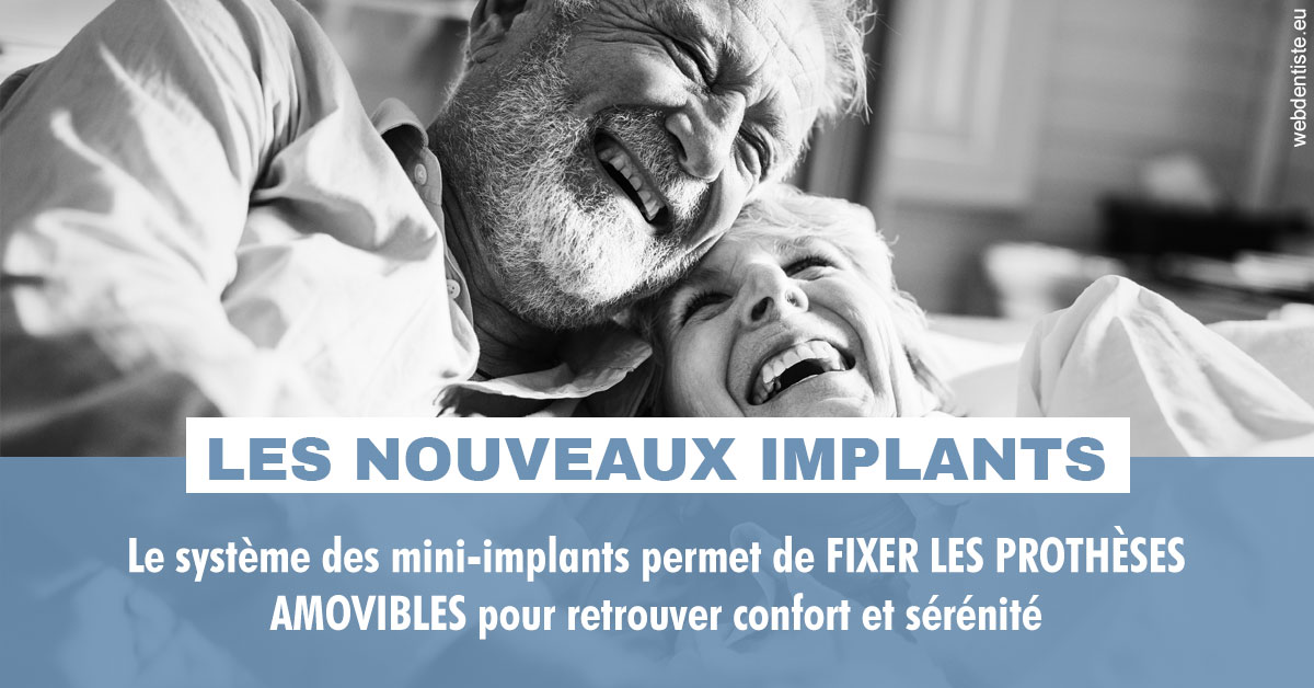 https://dr-carine-ben-younes-uzan.chirurgiens-dentistes.fr/Les nouveaux implants 2