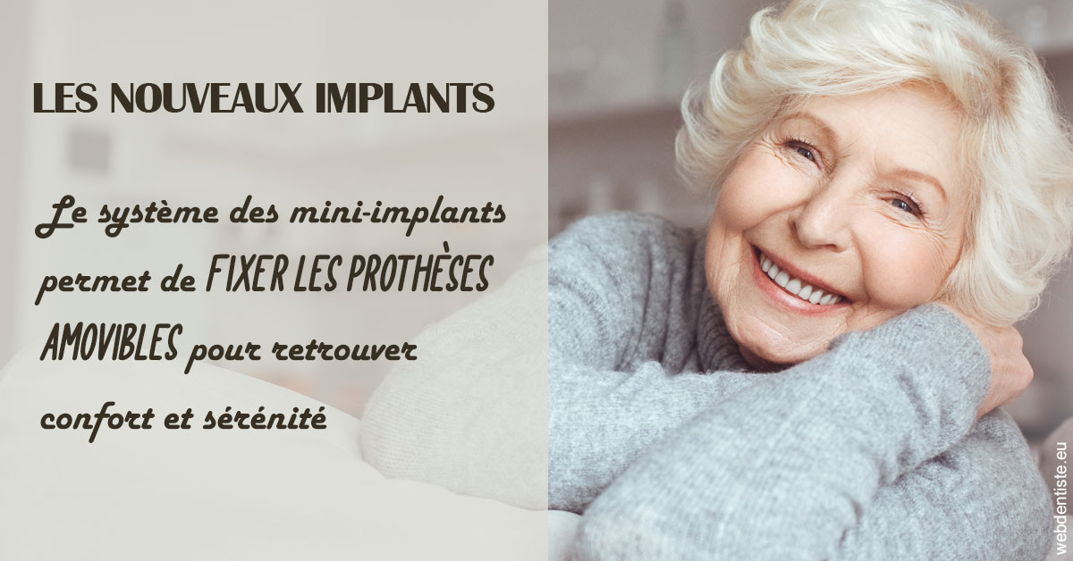 https://dr-carine-ben-younes-uzan.chirurgiens-dentistes.fr/Les nouveaux implants 1