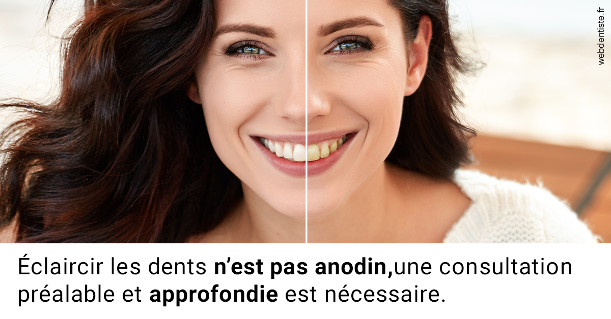 https://dr-carine-ben-younes-uzan.chirurgiens-dentistes.fr/Le blanchiment 2
