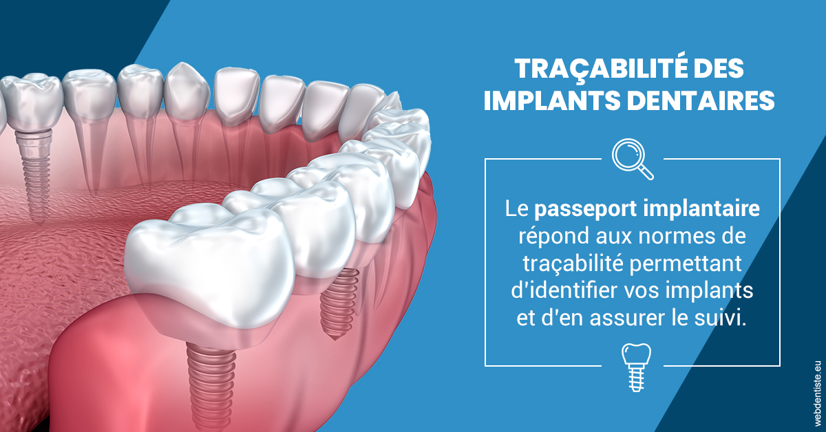 https://dr-carine-ben-younes-uzan.chirurgiens-dentistes.fr/T2 2023 - Traçabilité des implants 1