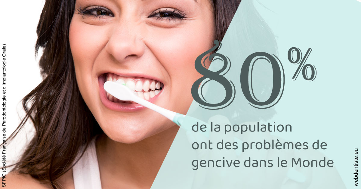 https://dr-carine-ben-younes-uzan.chirurgiens-dentistes.fr/Problèmes de gencive 1