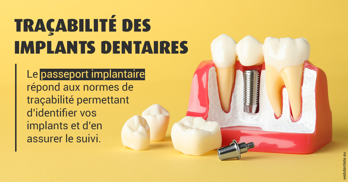 https://dr-carine-ben-younes-uzan.chirurgiens-dentistes.fr/T2 2023 - Traçabilité des implants 2