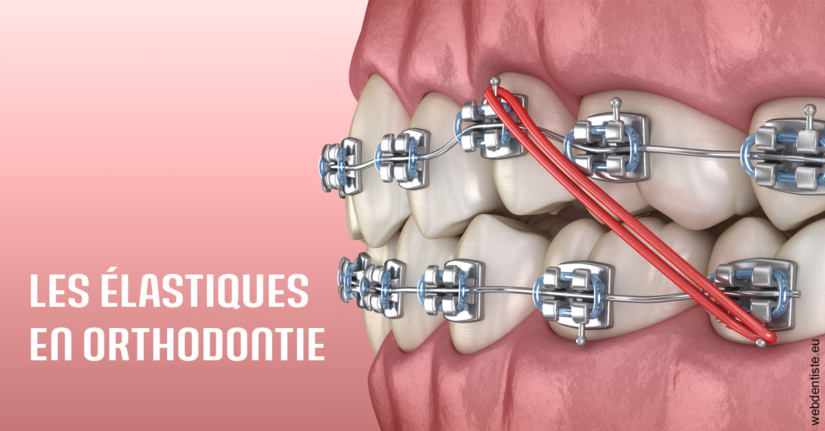 https://dr-carine-ben-younes-uzan.chirurgiens-dentistes.fr/Elastiques orthodontie 2