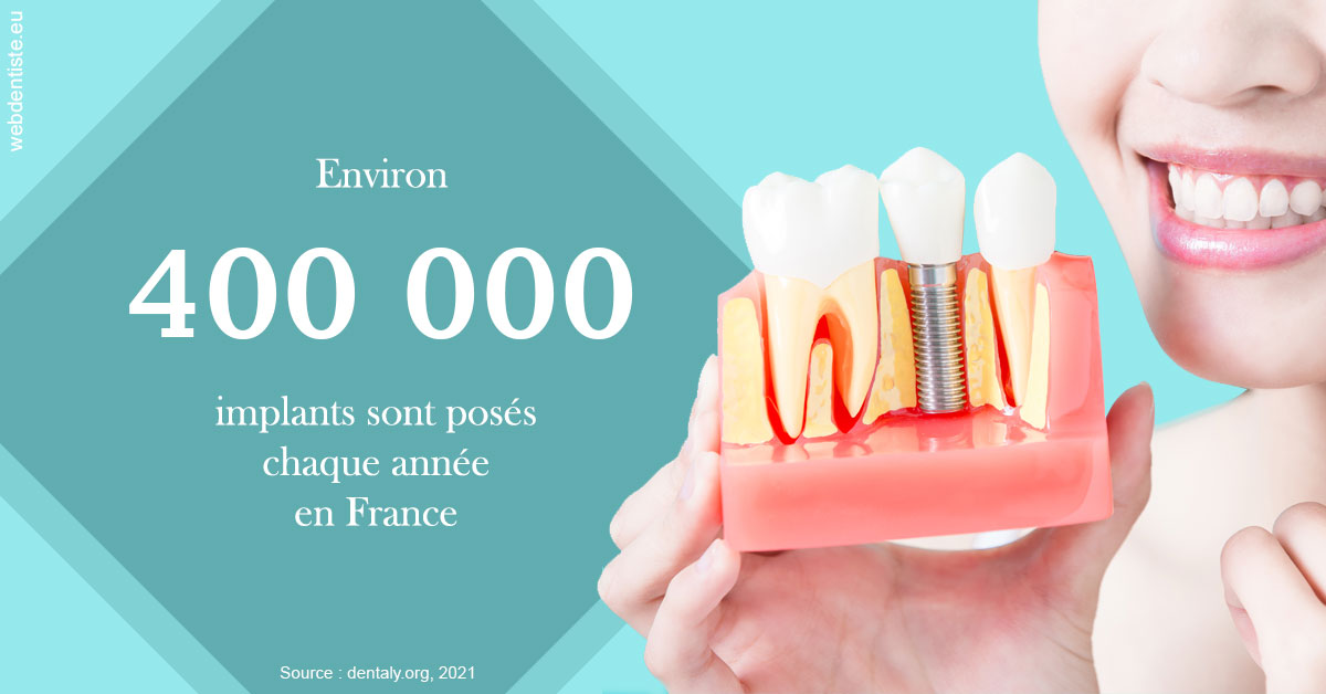 https://dr-carine-ben-younes-uzan.chirurgiens-dentistes.fr/Pose d'implants en France 2